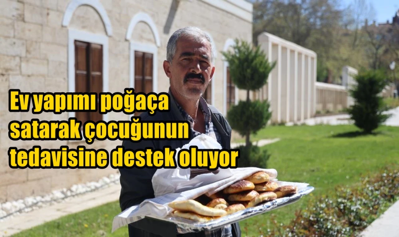Ev yapımı poğaça satarak çocuğunun tedavisine destek oluyor
