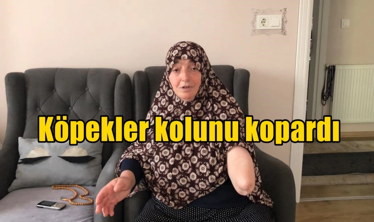 Köpekler kolunu kopardı