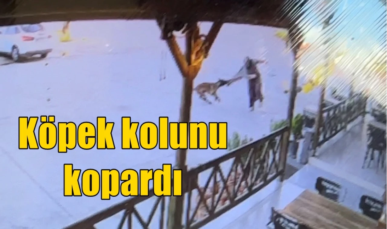 Köpek kolunu kopardı