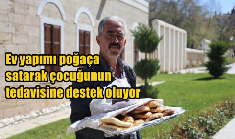 Ev yapımı poğaça satarak çocuğunun tedavisine destek oluyor