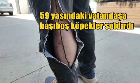 59 yaşındaki vatandaşa başıboş köpekler saldırdı